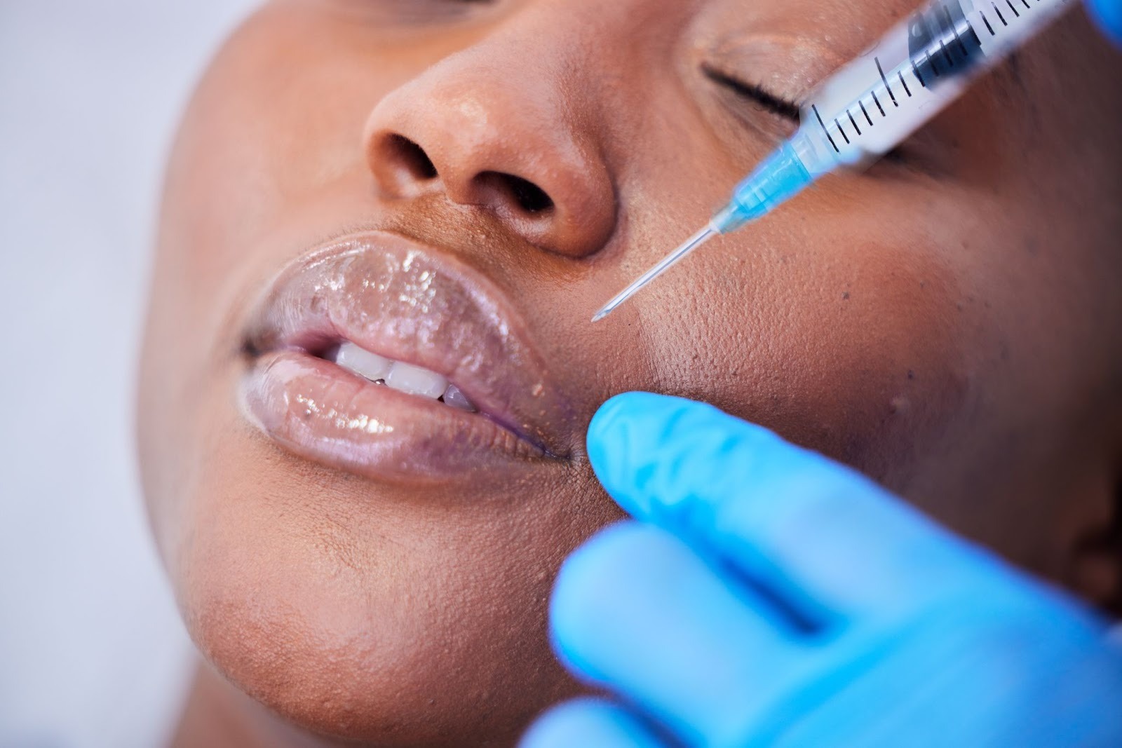A doctor holds a syringe close to a woman’s face to administer a dermal filler.